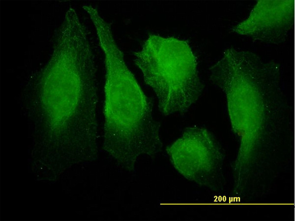 CAMK2B Antibody in Immunocytochemistry (ICC/IF)