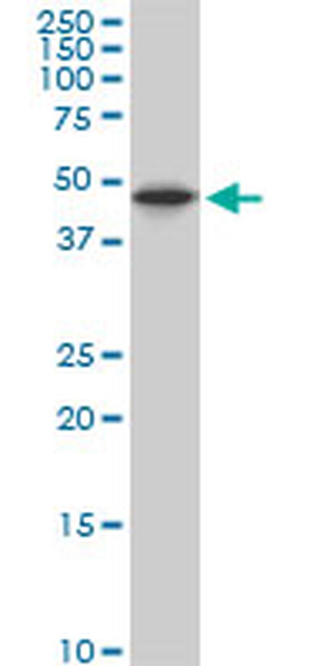 CAMK2B Antibody in Western Blot (WB)