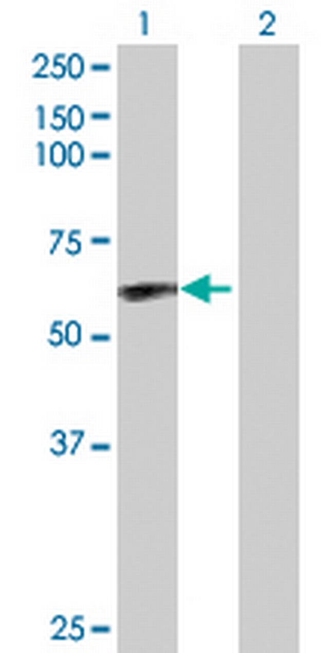 CAMK2D Antibody in Western Blot (WB)