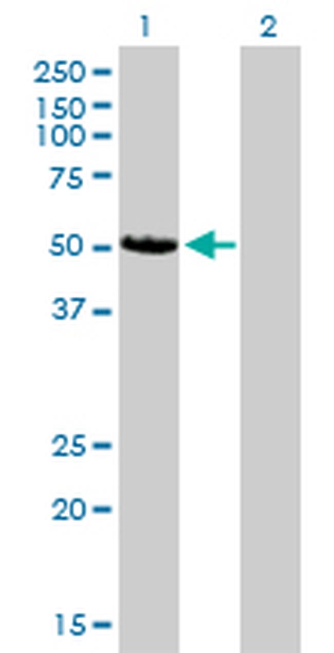 CAMK2D Antibody in Western Blot (WB)