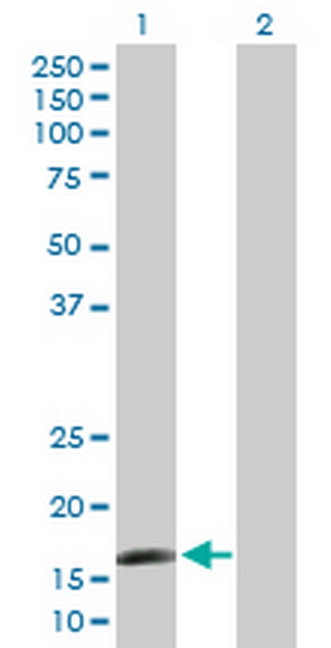 CAMP Antibody in Western Blot (WB)