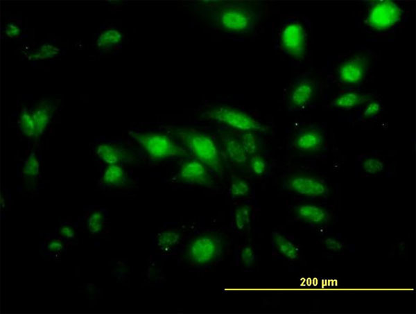 CAPG Antibody in Immunocytochemistry (ICC/IF)