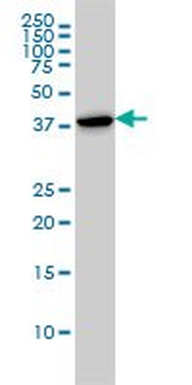 CAPG Antibody in Western Blot (WB)