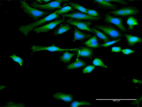 CAPN1 Antibody in Immunocytochemistry (ICC/IF)