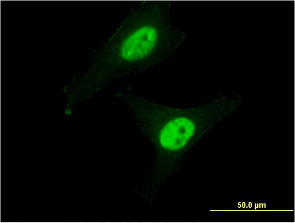 CAPN3 Antibody in Immunocytochemistry (ICC/IF)