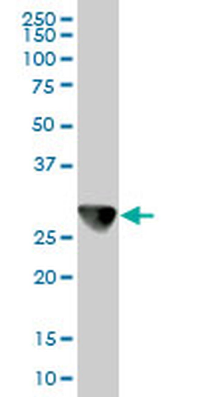 CAPZB Antibody in Western Blot (WB)