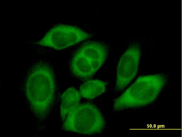 CARS Antibody in Immunocytochemistry (ICC/IF)