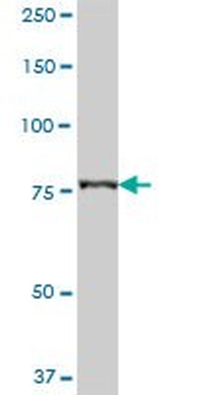 CARS Antibody in Western Blot (WB)