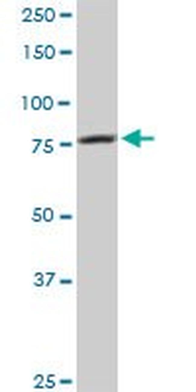 CARS Antibody in Western Blot (WB)