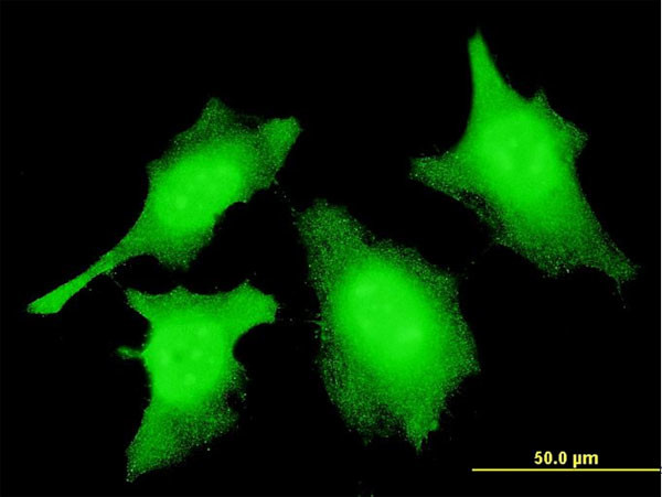 CASP2 Antibody in Immunocytochemistry (ICC/IF)