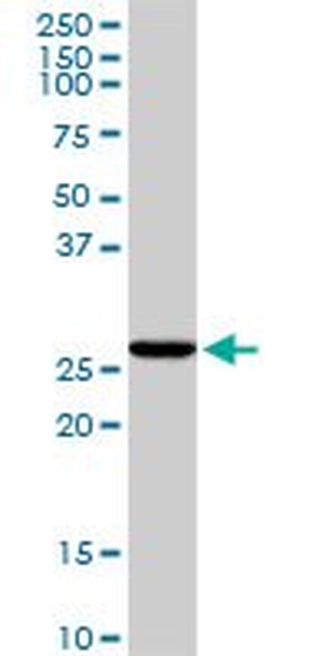 CASP6 Antibody in Western Blot (WB)