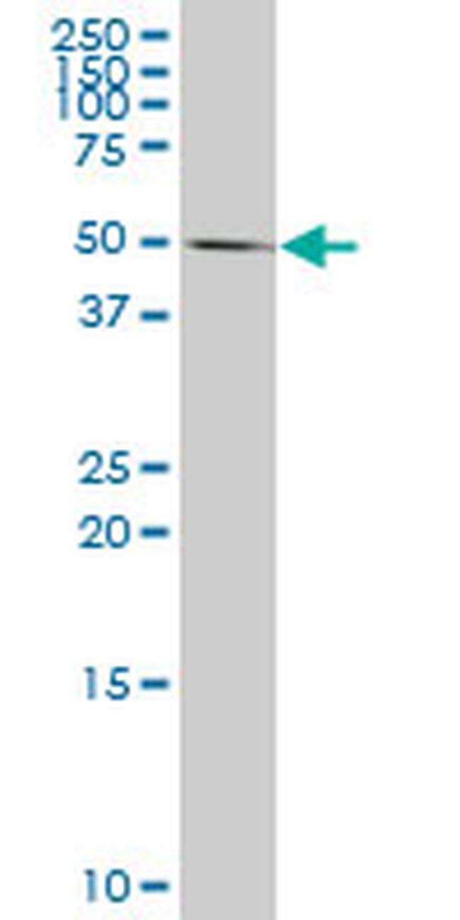 CASP10 Antibody in Western Blot (WB)