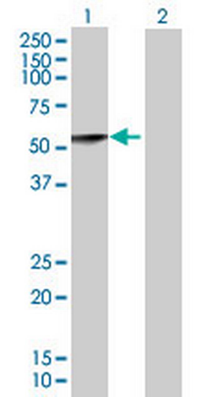 CASQ2 Antibody in Western Blot (WB)