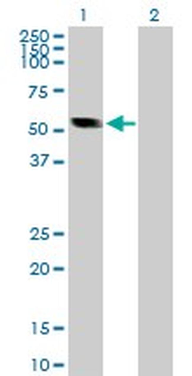 CASQ2 Antibody in Western Blot (WB)