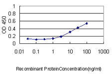 CASQ2 Antibody in ELISA (ELISA)