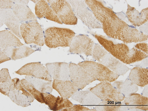 CASQ2 Antibody in Immunohistochemistry (Paraffin) (IHC (P))