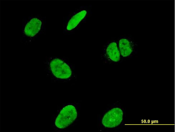 RUNX2 Antibody in Immunocytochemistry (ICC/IF)