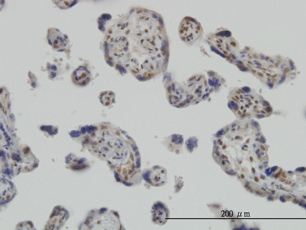 RUNX2 Antibody in Immunohistochemistry (Paraffin) (IHC (P))