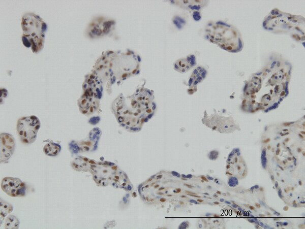 RUNX2 Antibody in Immunohistochemistry (Paraffin) (IHC (P))