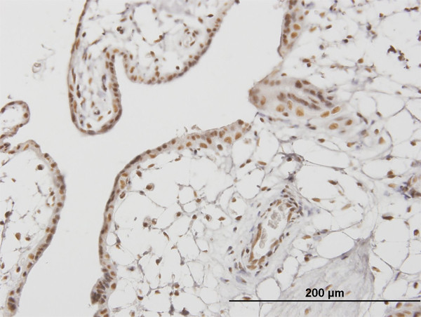 RUNX1 Antibody in Immunohistochemistry (Paraffin) (IHC (P))