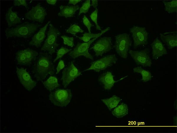 RUNX1 Antibody in Immunocytochemistry (ICC/IF)