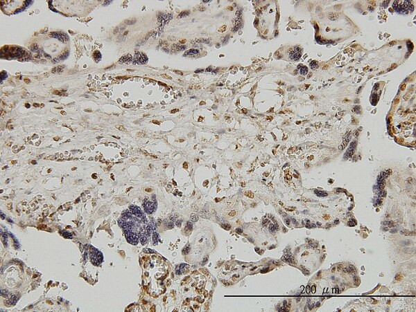 RUNX1 Antibody in Immunohistochemistry (Paraffin) (IHC (P))