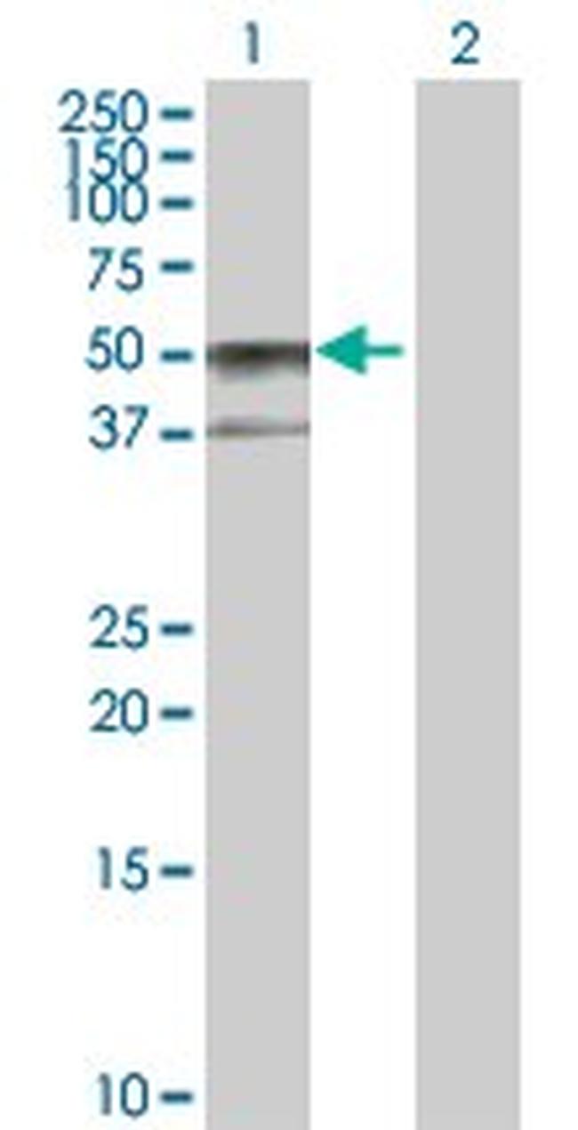 SERPINA6 Antibody in Western Blot (WB)