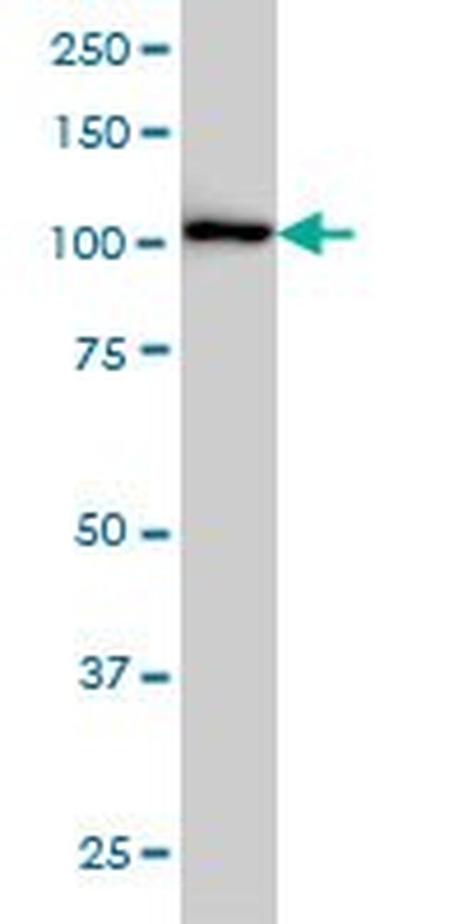 CBL Antibody in Western Blot (WB)