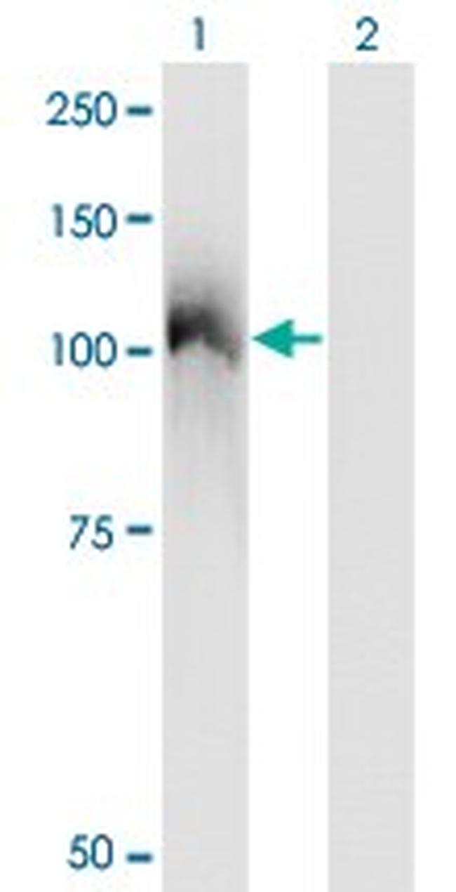 CBL Antibody in Western Blot (WB)