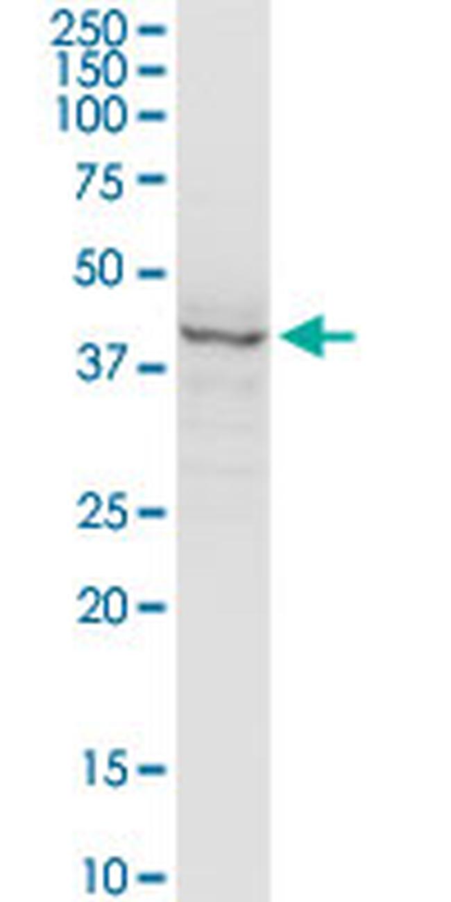 SERPINH1 Antibody in Western Blot (WB)