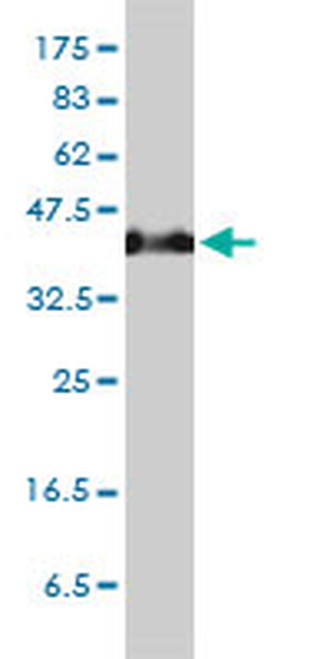 SERPINH1 Antibody in Western Blot (WB)