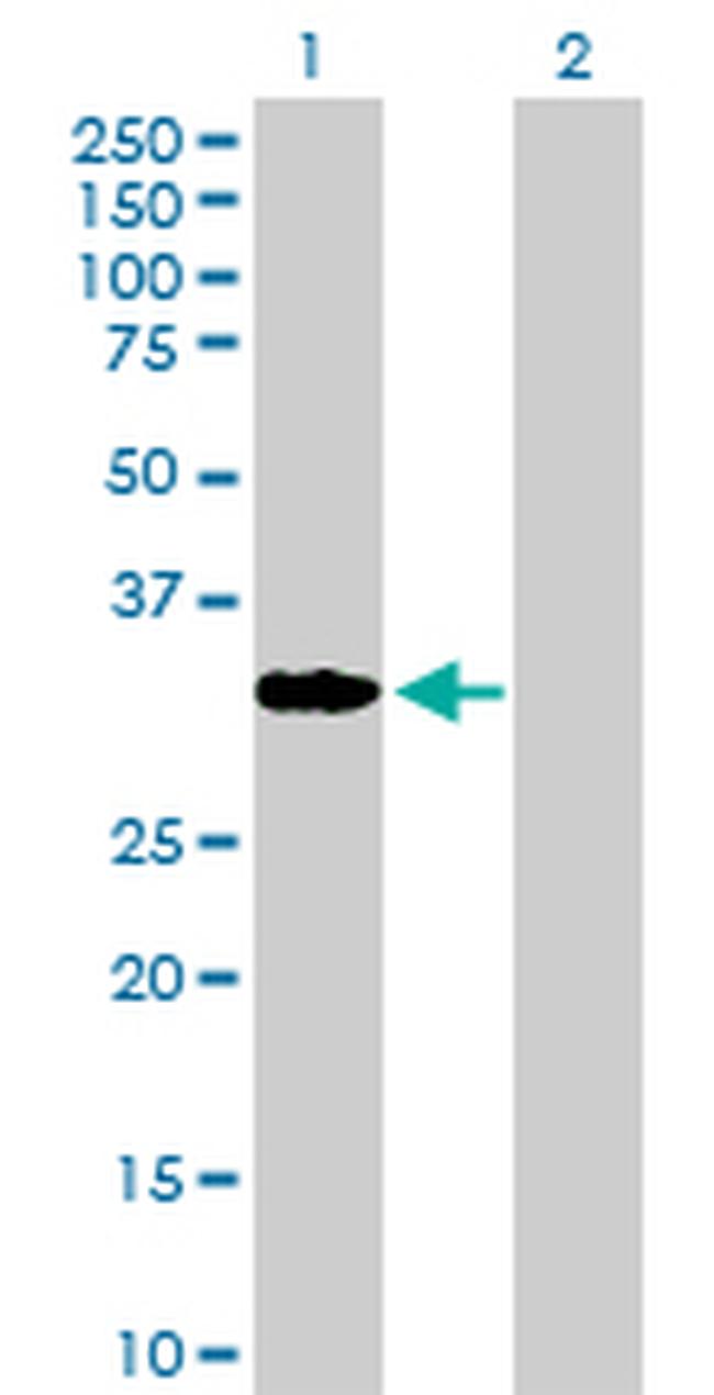 CBR1 Antibody in Western Blot (WB)