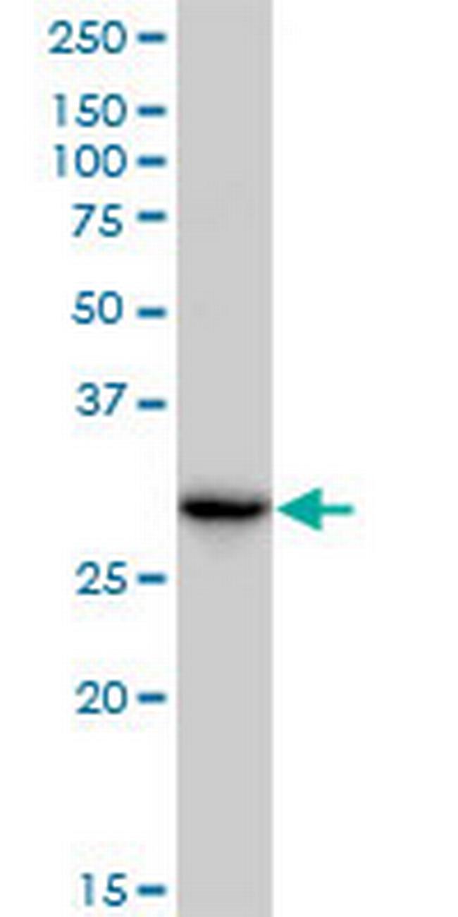 CBR3 Antibody in Western Blot (WB)