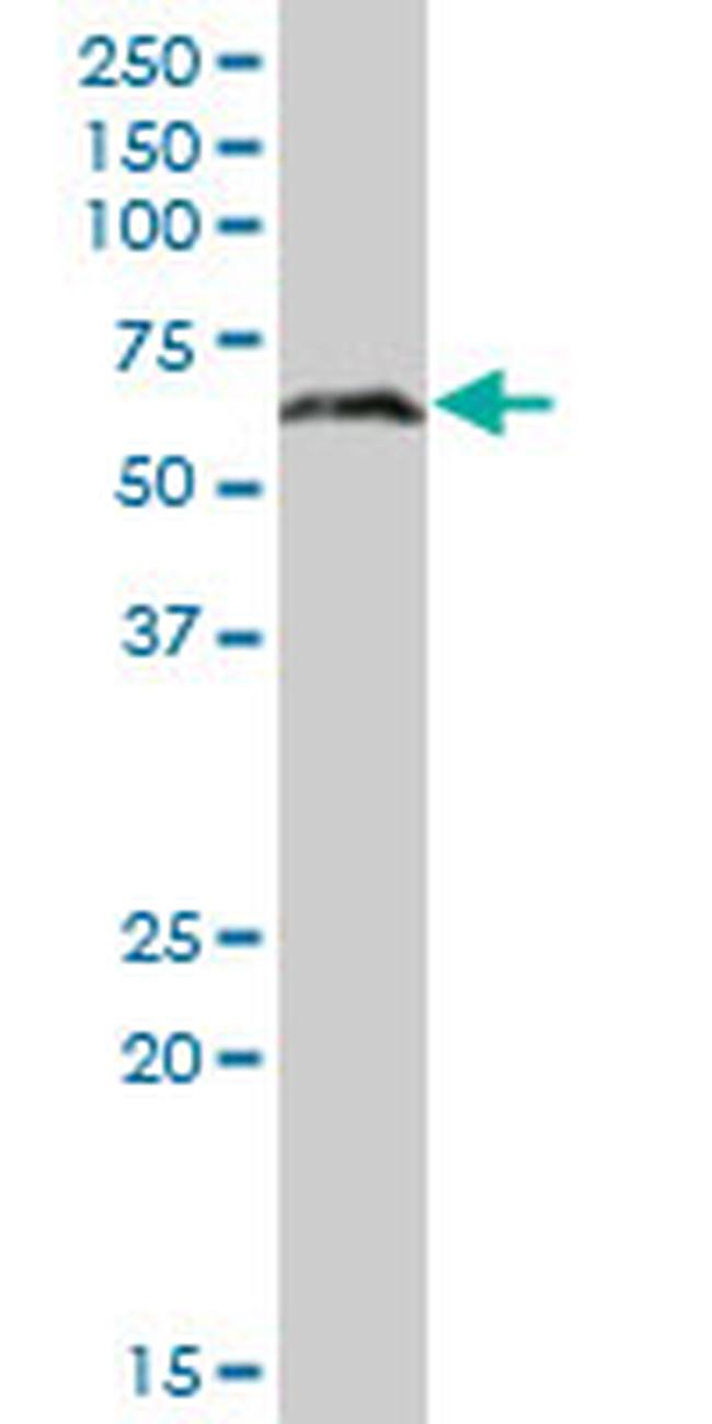 CBS Antibody in Western Blot (WB)