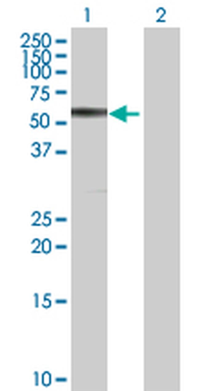 CBS Antibody in Western Blot (WB)