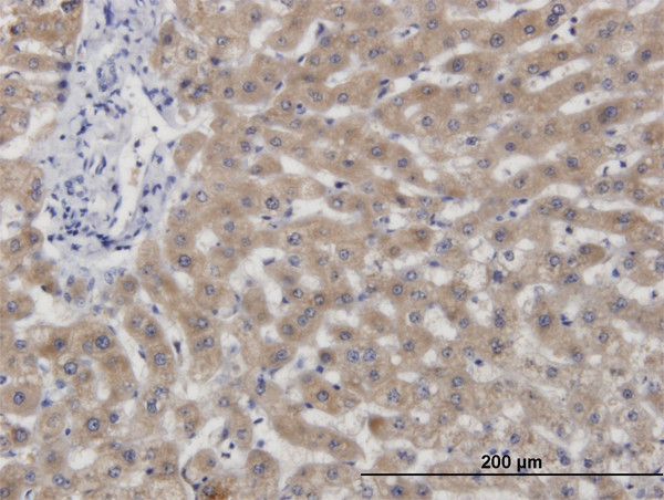 CBS Antibody in Immunohistochemistry (Paraffin) (IHC (P))