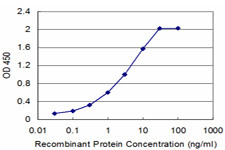 CBS Antibody in ELISA (ELISA)