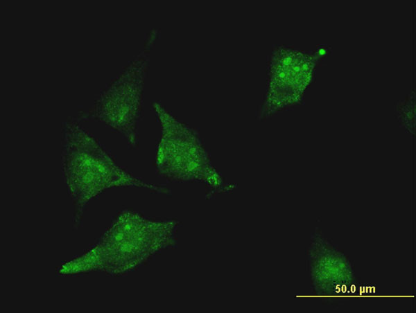 CBS Antibody in Immunocytochemistry (ICC/IF)