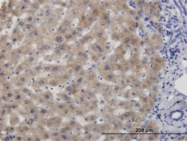 CBS Antibody in Immunohistochemistry (Paraffin) (IHC (P))