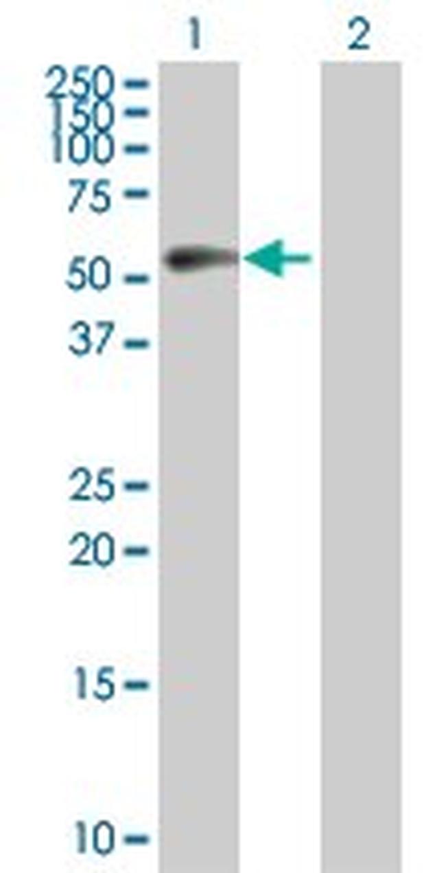 CCNB1 Antibody in Western Blot (WB)