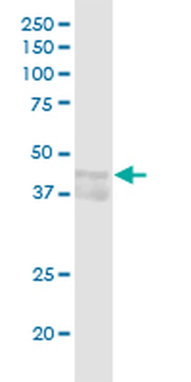 CCNE1 Antibody in Western Blot (WB)