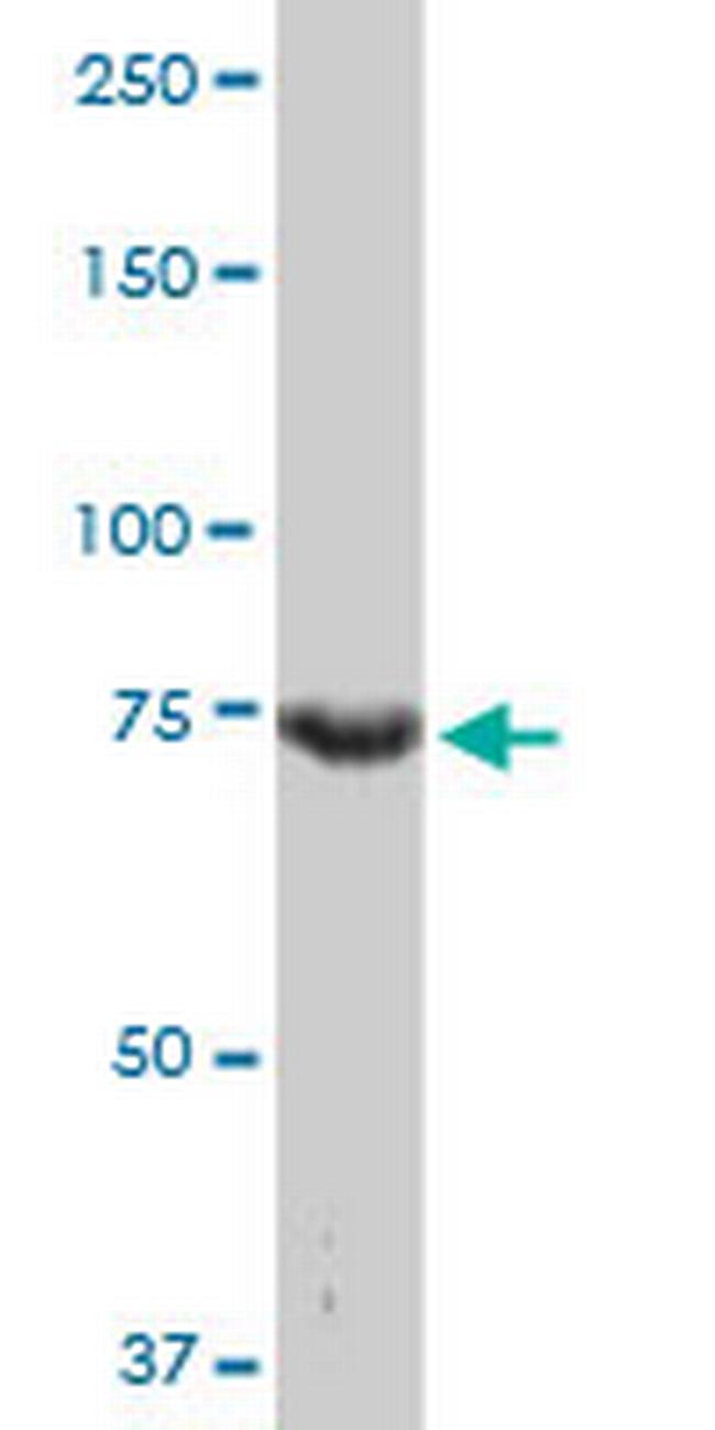 CCNT2 Antibody in Western Blot (WB)