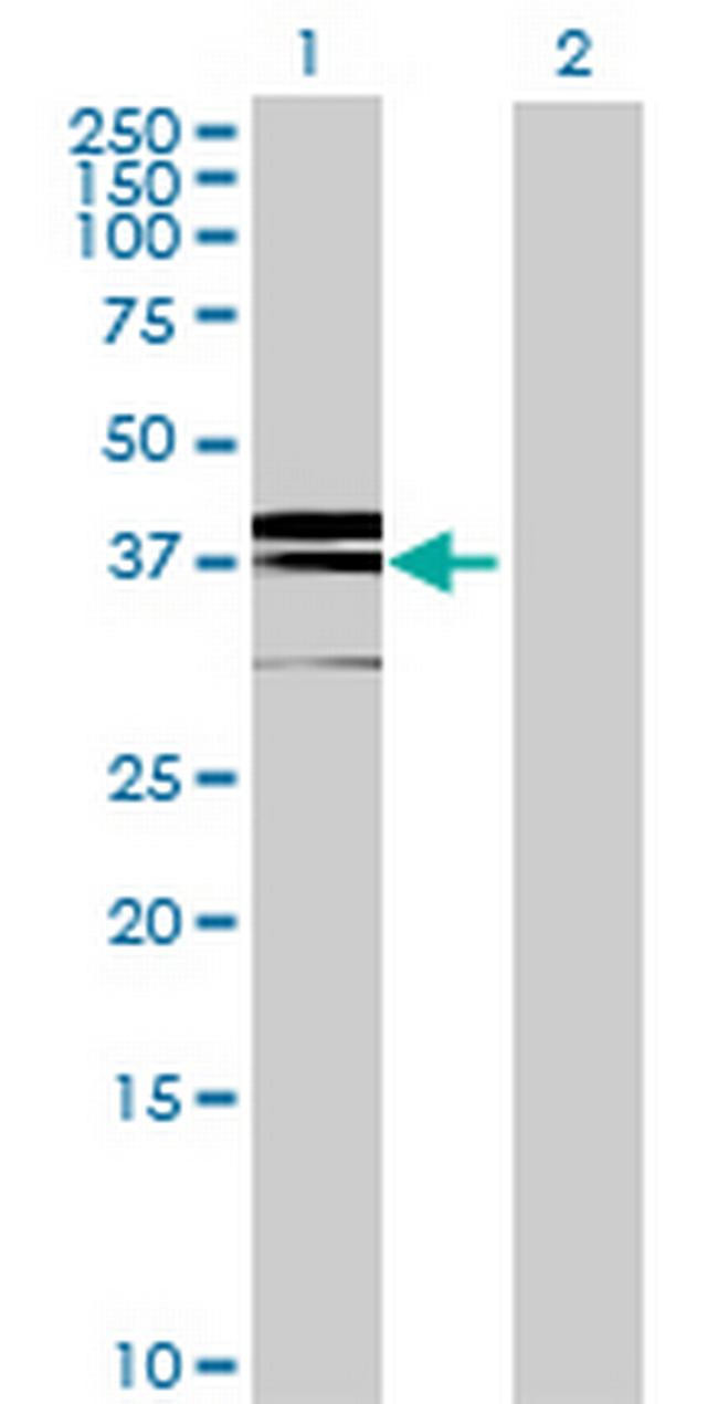 CD1B Antibody in Western Blot (WB)