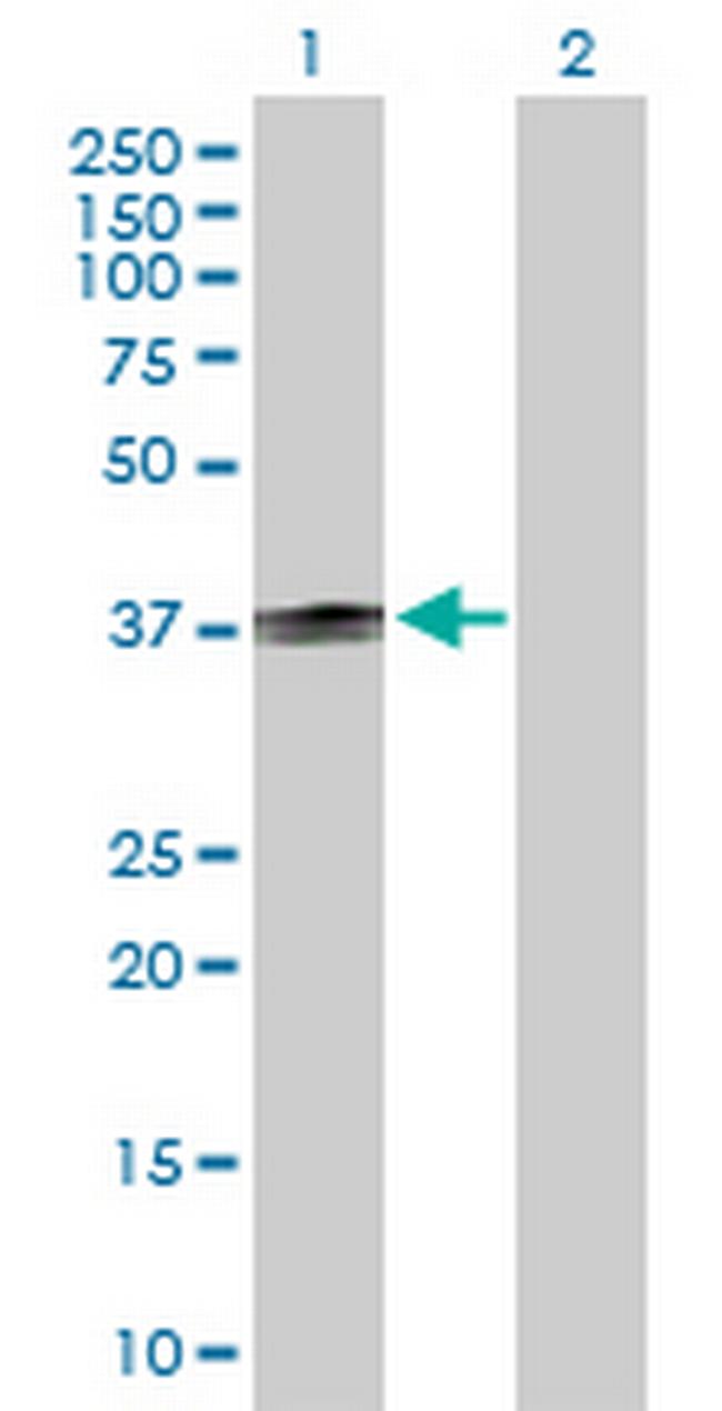 CD1B Antibody in Western Blot (WB)