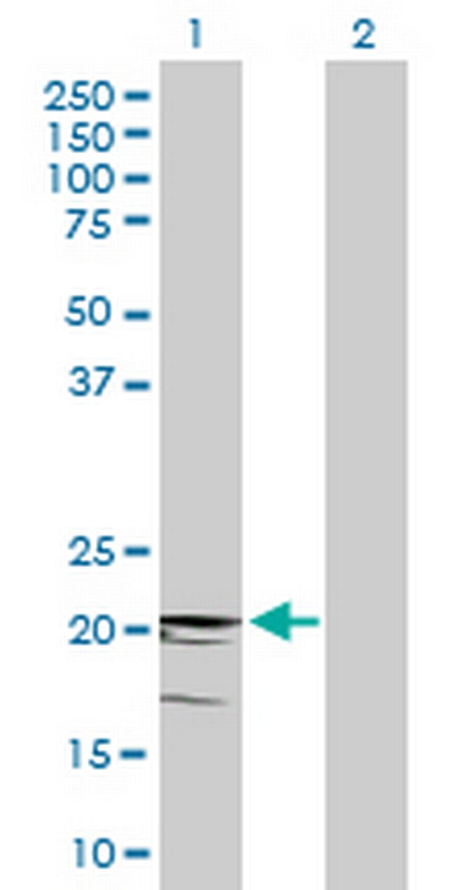 CD3D Antibody in Western Blot (WB)