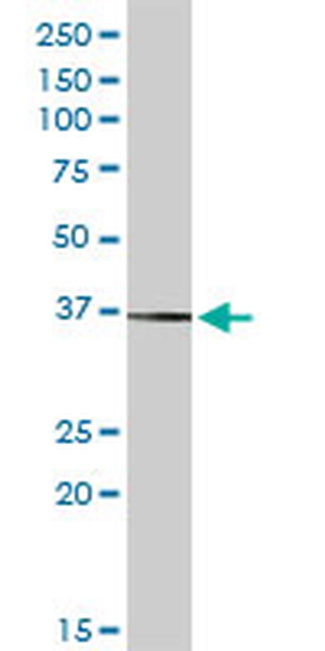 SIGLEC6 Antibody in Western Blot (WB)