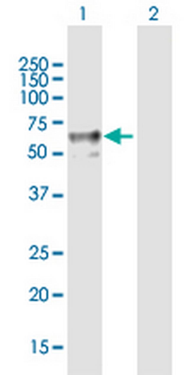 ENTPD2 Antibody in Western Blot (WB)