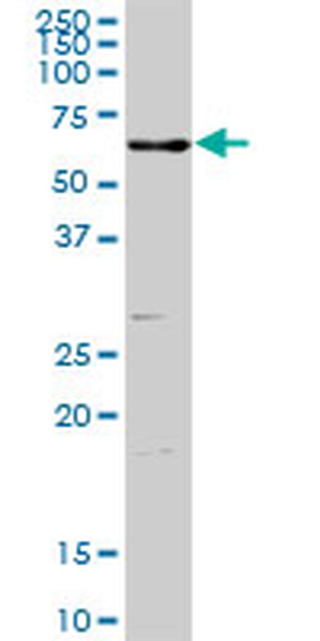 ENTPD3 Antibody in Western Blot (WB)