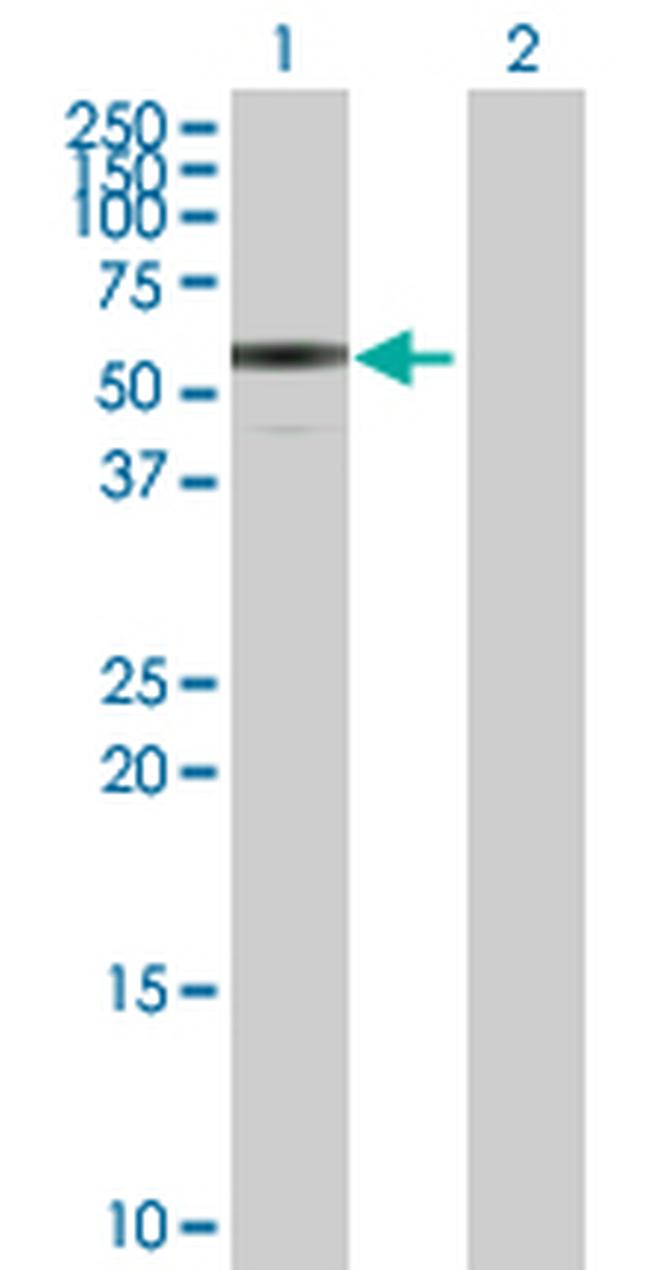 ENTPD3 Antibody in Western Blot (WB)