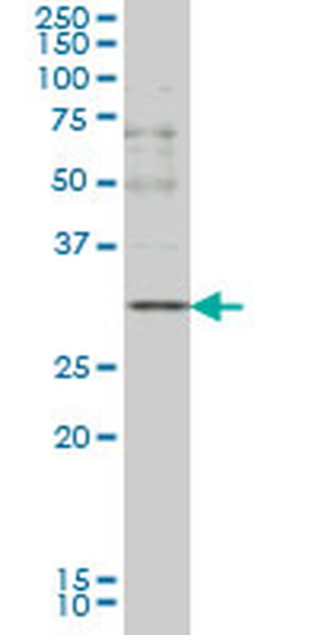 CD40LG Antibody in Western Blot (WB)